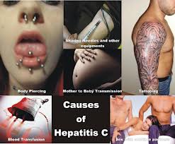 Hepatite c: diagnóstico, evolução e tratamento – parte i